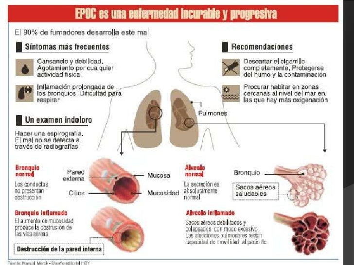 epoc exacerbado